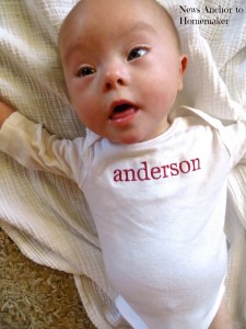 Days Before Open Heart Surgery, Down syndrome, baby, congenital heart defect in newborns