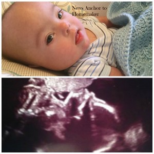 Anniversary of receiving down syndrome diagnosis ultrasound