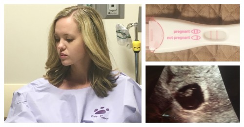 miscarriage after a down syndrome pregnancy ultrasound picture no heart beat 8 weeks 6 weeks