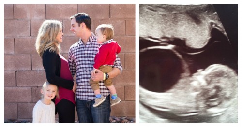 rainbow baby posterior urethral valve puv ultrasound 14 weeks blog post